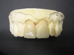 ceramica integrale