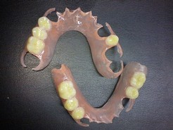 PROTESI IN FJP (NYLON)