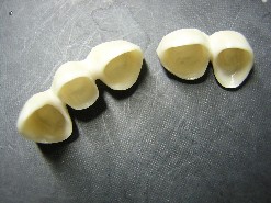 CERAMICA SU ZIRCONIA
