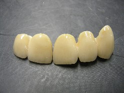 CERAMICA SU ZIRCONIA
